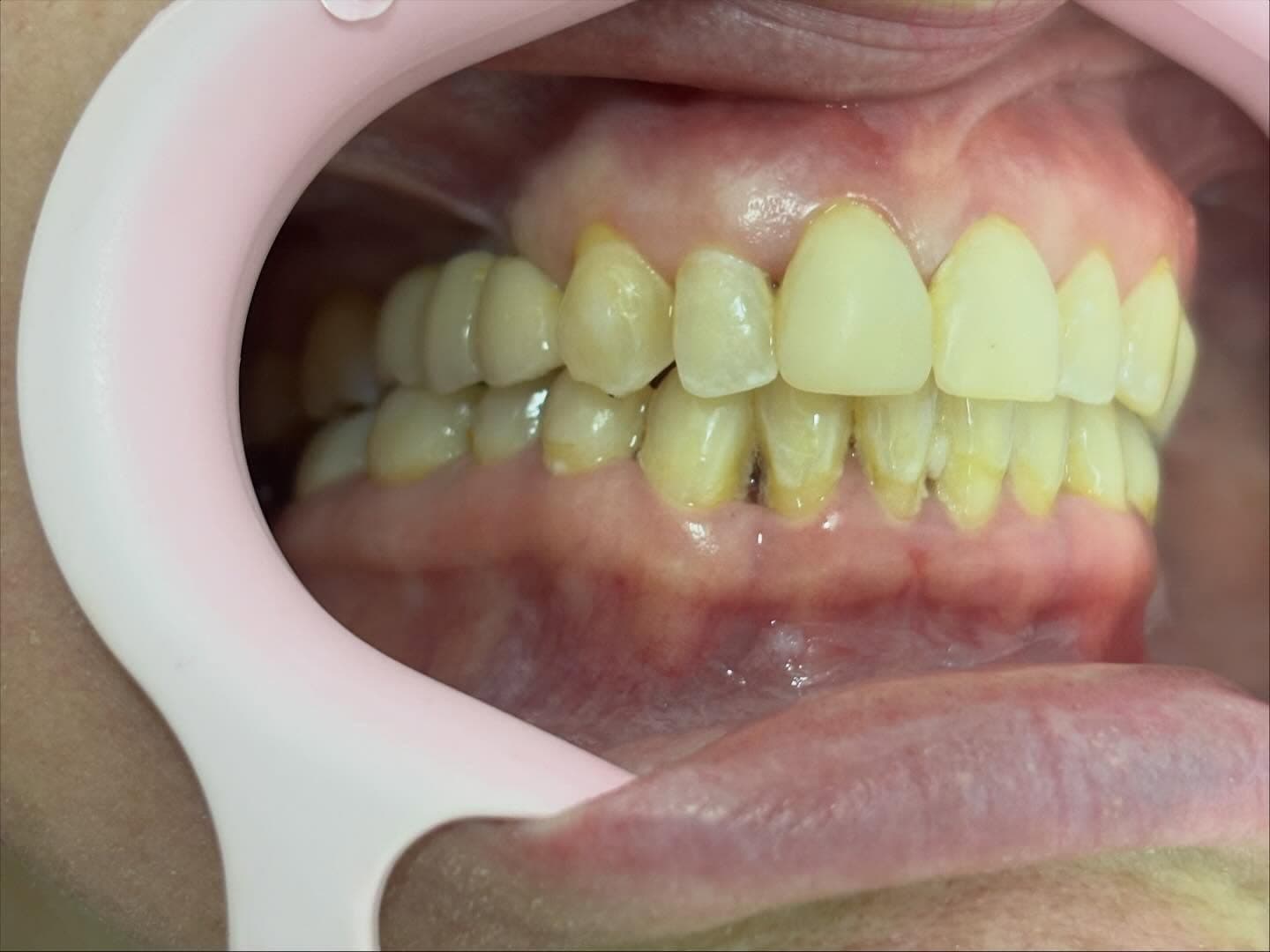 close em dentes durante atendimento odontológico