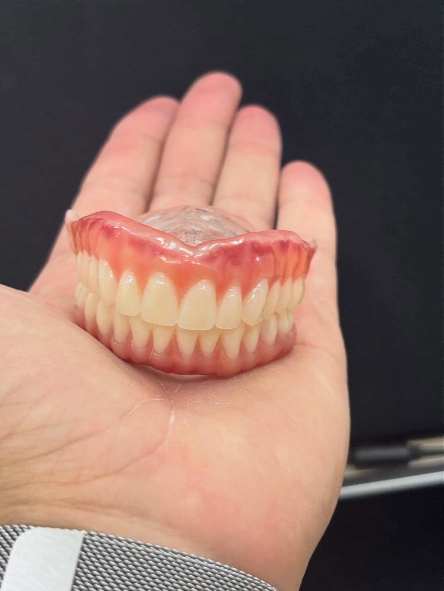 Modelo de prótese dentária na mão, boa iluminação.