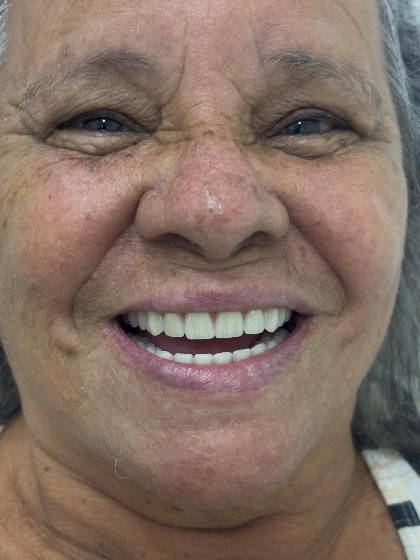 Depois — Resultado real