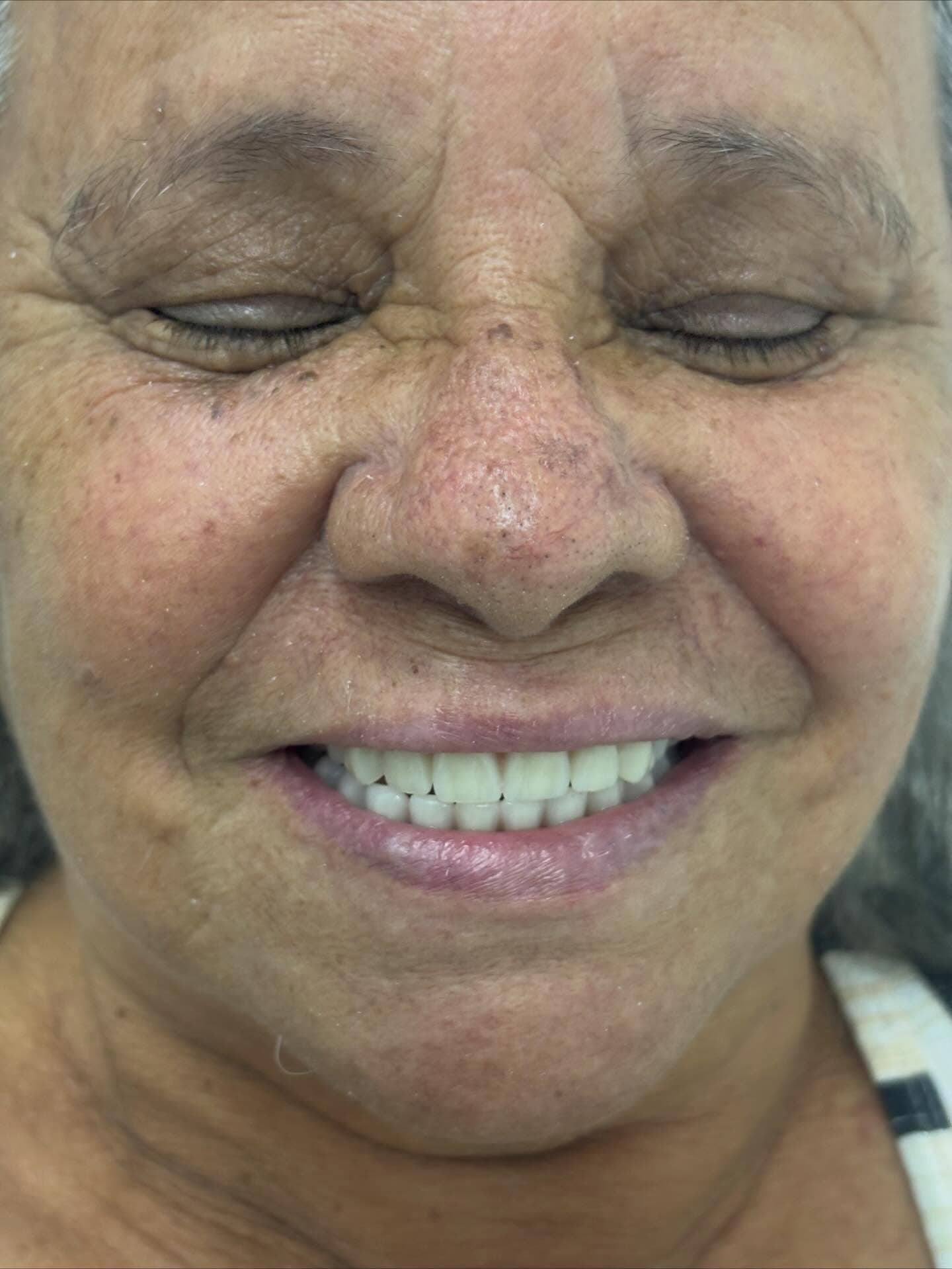 Depois — Resultado real