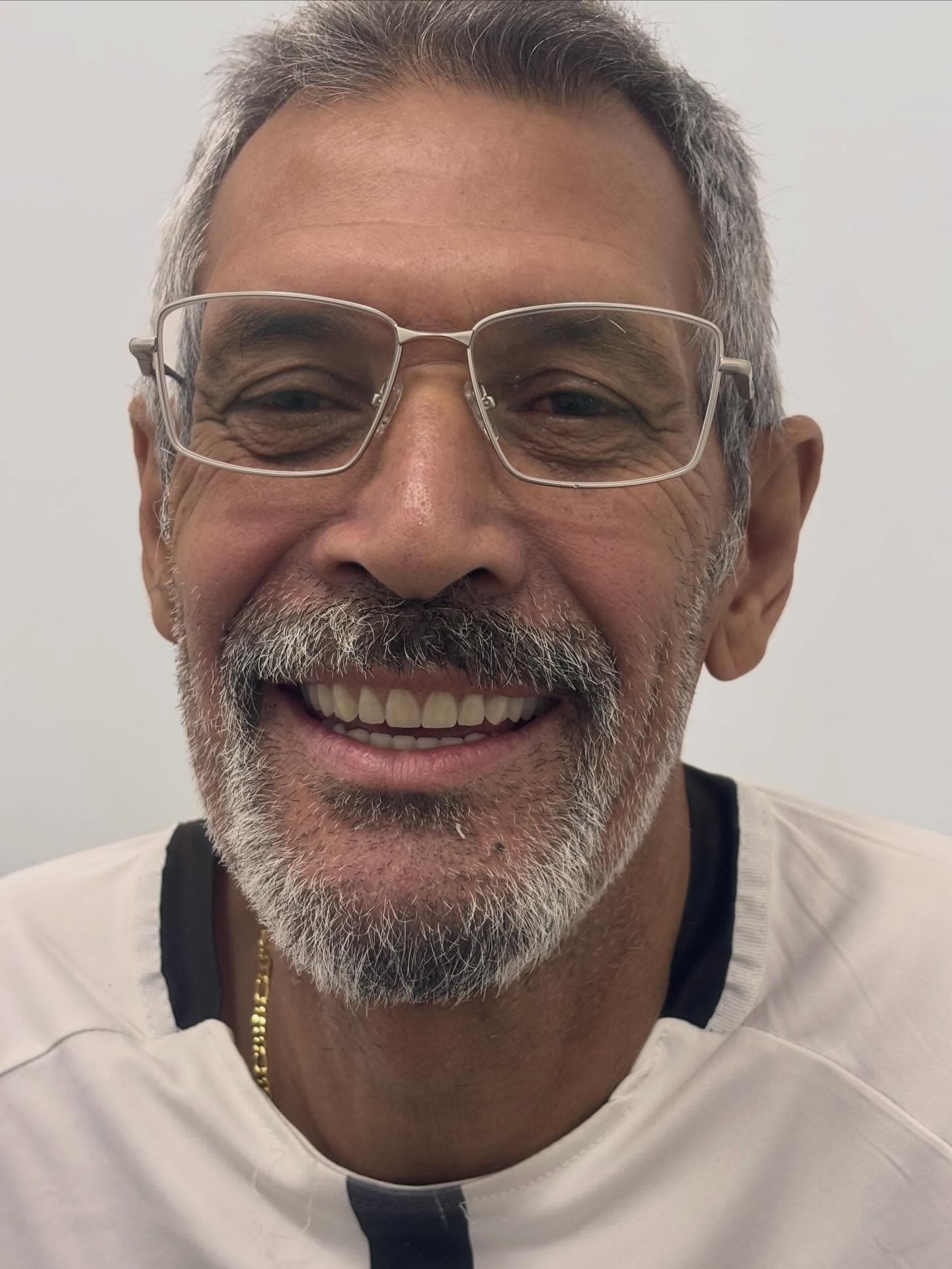 Depois — Resultado real